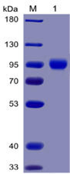 Human CD155 Recombinant Protein mFc-His Tag HDPT0027