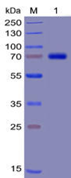 Human TIM3 Recombinant Protein mFc-His Tag HDPT0030