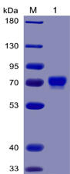 Human MSLN296-580 Recombinant Protein mFc-His Tag HDPT0031