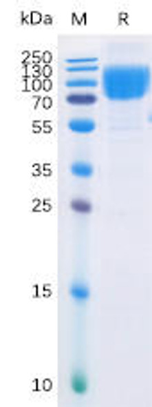 Human B7-2 Recombinant Protein mFc-His Tag HDPT0034