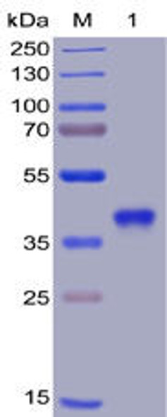 SARS-CoV-2 2019-nCoV S protein RBD, His Tag HDPT0036