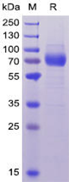 Human CD33 Recombinant Protein hFc-His Tag HDPT0037