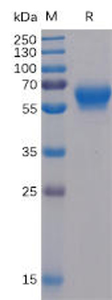 Human BTLA Recombinant Protein mFc-His Tag HDPT0043