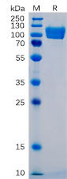 Human ICAM-1 Recombinant Protein mFc Tag HDPT0049