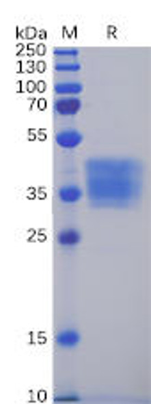 Human CLDN6 Recombinant Protein mFc Tag HDPT0050