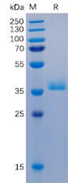 Human GPRC5D Recombinant Protein hFc-His Tag HDPT0051