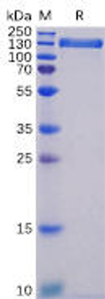 Human ACE2 Recombinant Protein hFc Tag HDPT0058