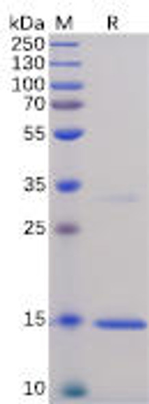 Human TNFa Recombinant Protein His Tag HDPT0060
