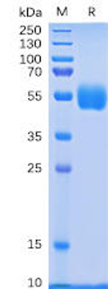 Human NKp30 Recombinant Protein hFc Tag HDPT0062