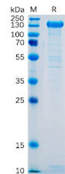 Human SELP Recombinant Protein hFc Tag HDPT0066