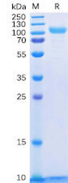 Human HER3 Recombinant Protein His Tag HDPT0067