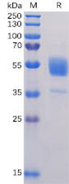 Human CD37 Recombinant Protein hFc Tag HDPT0068