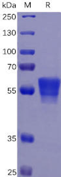 Human CD7 Recombinant Protein mFc Tag HDPT0078