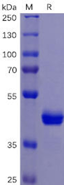 Human TNFRSF10B Recombinant Protein mFc Tag HDPT0079