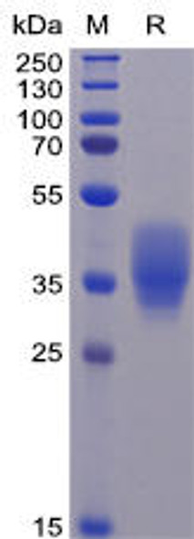 Human CD200 Recombinant Protein His Tag HDPT0080