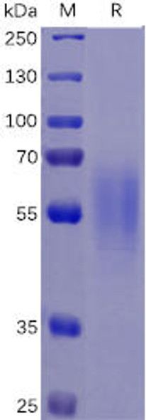 Human IL17RA Recombinant Protein His Tag HDPT0081