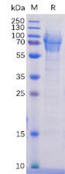 Human CD162 Recombinant Protein His Tag HDPT0084