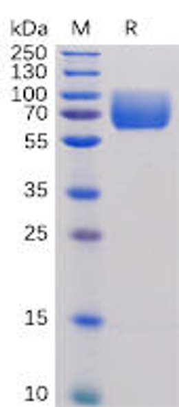 Human B7-2 Recombinant Protein hFc Tag HDPT0086