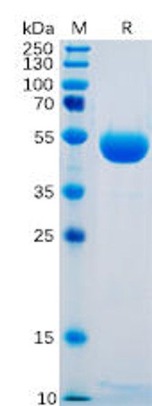 Human CTLA-4 Recombinant Protein hFc Tag HDPT0091