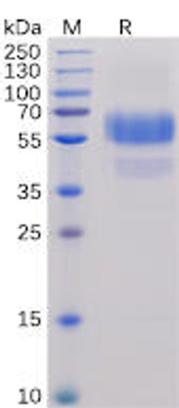 Human CD70 Recombinant Protein hFc-His Tag HDPT0096