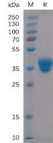 Human IgG1-Fc Recombinant Protein HDPT0104