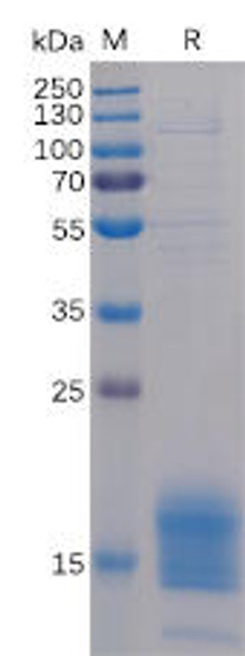 Human TIGIT Recombinant Protein His Tag HDPT0110