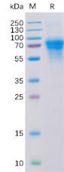 Human CD46 Recombinant Protein His Tag HDPT0119