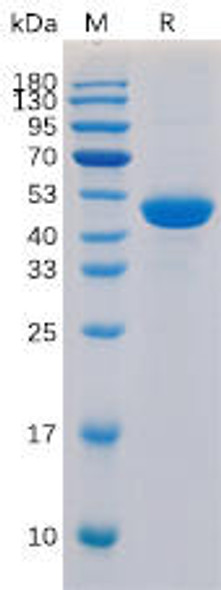 Human CD40 Ligand Recombinant Protein hFc Tag HDPT0121