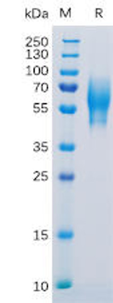 Human 5T4 Recombinant Protein His Tag HDPT0126