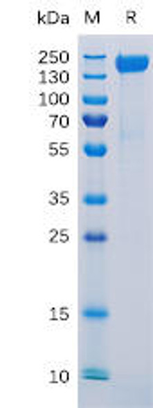 Human CD171 Recombinant Protein His Tag HDPT0128