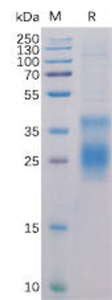 Human HVEM Recombinant Protein His Tag HDPT0129