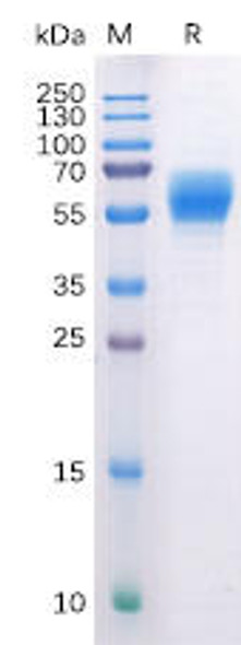 Human CB1 Recombinant Protein hFc Tag HDPT0135