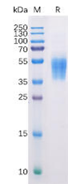 Human B7-H6 Recombinant Protein His Tag HDPT0137