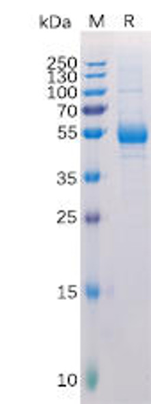 Human TNFSF11 Recombinant Protein hFc Tag HDPT0138