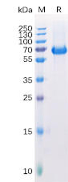 Human EPHA2 Recombinant Protein His Tag HDPT0141