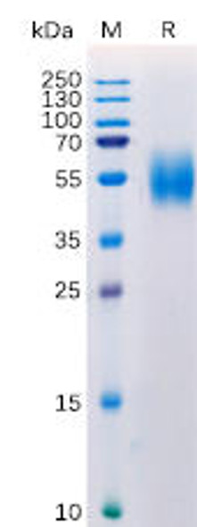 Human MICA Recombinant Protein His Tag HDPT0142