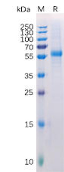 Human LAG3 Recombinant Protein His Tag HDPT0145