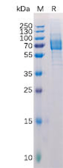 Human Galectin 9 Recombinant Protein hFc Tag HDPT0147