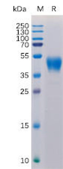 Human CD24 Recombinant Protein hFc Tag HDPT0149