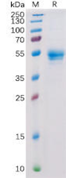 Human CD160 Recombinant Protein hFc Tag HDPT0150