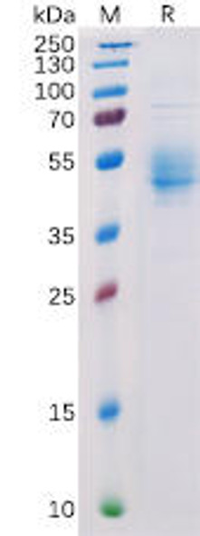 Human PVRIG Recombinant Protein hFc Tag HDPT0151