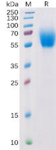 Human IL13RA1 Recombinant Protein His Tag HDPT0153
