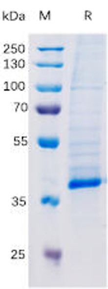 Human TGFB1 Recombinant Protein hFc Tag HDPT0164