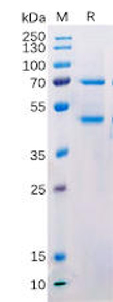 Human MASP2 Recombinant Protein hFc Tag HDPT0172