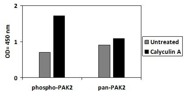 Human Phospho-PAK2 Ser20 and Total PAK2 PharmaGenie ELISA Kit SBRS1923