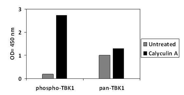 Human, Mouse and Rat Phospho-TBK1 S172 and Total TBK1 PharmaGenie ELISA Kit SBRS2000