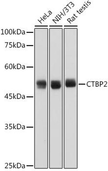 Anti-CTBP2 Antibody CAB0463