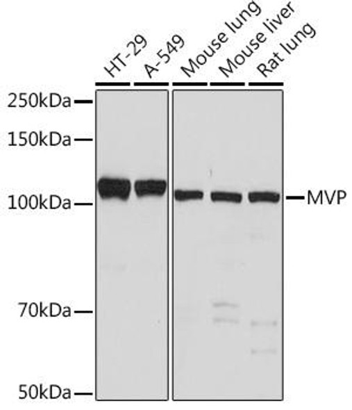 Anti-MVP Antibody CAB1039