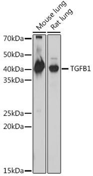 Anti-TGFB1 KO Validated Antibody CAB18692