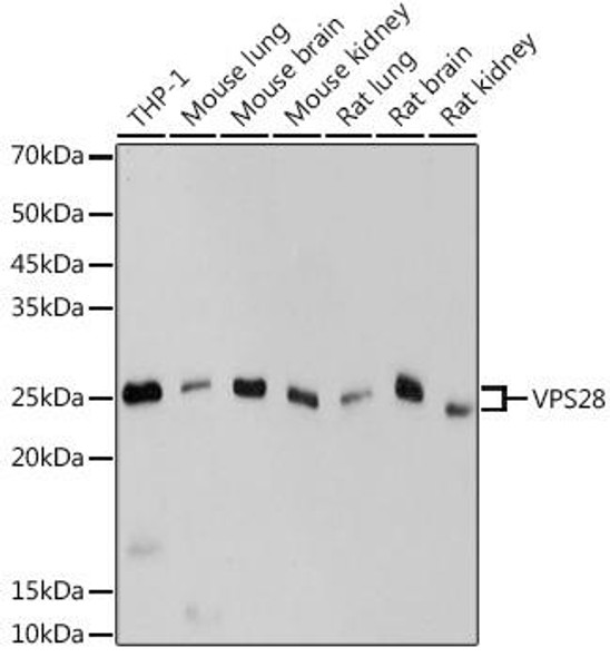 Anti-VPS28 Antibody CAB19240